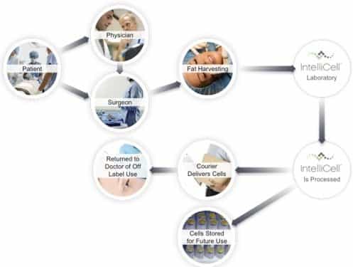 Intelli Process